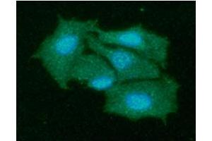 ICC/IF analysis of KIR2DL1 in Hep3B cells line, stained with DAPI (Blue) for nucleus staining and monoclonal anti-human KIR2DL1 antibody (1:100) with goat anti-mouse IgG-Alexa fluor 488 conjugate (Green). (KIR2DL1 Antikörper)
