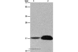 Western blot analysis of Mouse kidney and human kidney tissue, using FHIT Polyclonal Antibody at dilution of 1:600 (FHIT Antikörper)