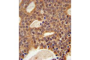 Immunohistochemistry (IHC) image for anti-DNA Cross-Link Repair 1B (DCLRE1B) antibody (ABIN3002342) (DCLRE1B Antikörper)