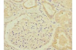 Immunohistochemistry (IHC) image for anti-Golgi Brefeldin A Resistant Guanine Nucleotide Exchange Factor 1 (GBF1) (AA 1-85) antibody (ABIN7154322)