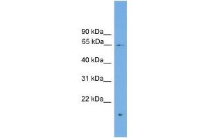 WB Suggested Anti-ZNF320 Antibody Titration: 0.