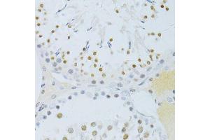 Immunohistochemistry of paraffin-embedded rat testis using Phospho-RELA-S276 antibody (ABIN6003884) at dilution of 1/100 (40x lens). (NF-kB p65 Antikörper  (pSer276))