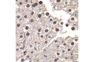 Immunohistochemistry of paraffin-embedded mouse liver using ST14 antibody at dilution of 1:200 (400x lens). (ST14 Antikörper)