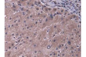 DAB staining on IHC-P; Samples: Human Liver Tissue (ABCB11 Antikörper  (AA 421-663))