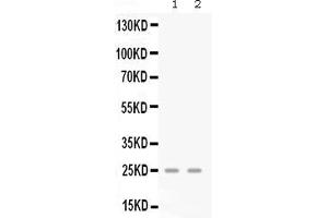 Western blot analysis of GRO gamma expression in mouse lung extract ( Lane 1) and mouse spleen extract ( Lane 2). (CXCL3 Antikörper  (AA 32-100))