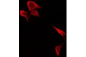 ABIN6278690 staining HepG2 by IF/ICC. (KR1_HHV11 Antikörper)