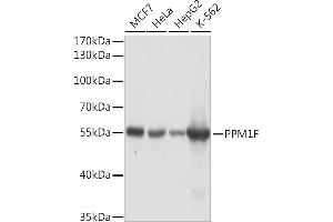 Western blot analysis of extracts of various cell lines, using PPM1F Rabbit pAb (ABIN7269682) at 1:1000 dilution. (PPM1F Antikörper  (AA 1-190))