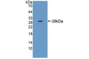 Detection of Recombinant CRMP1, Human using Polyclonal Antibody to Collapsin Response Mediator Protein 1 (CRMP1) (CRMP1 Antikörper  (AA 1-250))