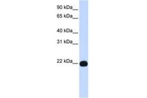 Image no. 1 for anti-Phosphatidylinositol Glycan Anchor Biosynthesis, Class A (PIGA) (AA 117-166) antibody (ABIN6743361) (PIGA Antikörper  (AA 117-166))