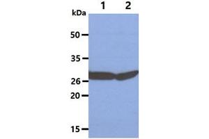 The Cell lysates (40ug) were resolved by SDS-PAGE, transferred to PVDF membrane and probed with anti-human SBDS antibody (1:3000).