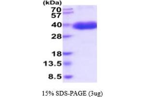 SDS-PAGE (SDS) image for Colony Stimulating Factor 1 (Macrophage) (CSF1) (AA 33-255) (Active) protein (His tag) (ABIN7281234) (M-CSF/CSF1 Protein (AA 33-255) (His tag))