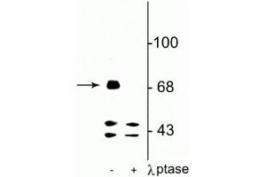 Western blot of rat hippocampal lysate showing specific immunolabeling of the ~71 kDa FMRP protein phosphorylated at Ser499 in the first lane (-).
