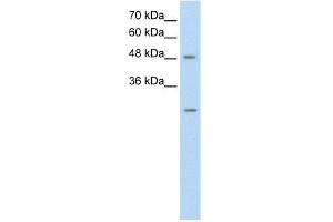 WB Suggested Anti-ANKRD2 Antibody Titration:  0. (ANKRD2 Antikörper  (N-Term))