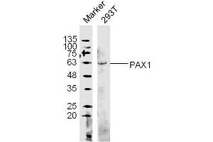 (Human Cell line) 293T lysates probed with PAX1 Polyclonal Antibody, unconjugated  at 1:300 overnight at 4°C followed by a conjugated secondary antibody at 1:10000 for 60 minutes at 37°C.