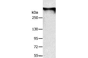 Western blot analysis of Mouse brain tissue, using RYR1 Polyclonal Antibody at dilution of 1:300