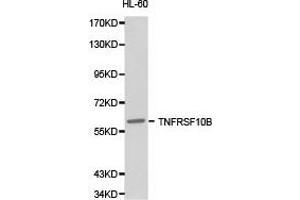 Western Blotting (WB) image for anti-Tumor Necrosis Factor Receptor Superfamily, Member 10b (TNFRSF10B) antibody (ABIN1875126) (TNFRSF10B Antikörper)