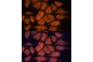 Immunofluorescence (IF) image for anti-UPF3 Regulator of Nonsense Transcripts Homolog A (UPF3A) (AA 327-476) antibody (ABIN7271227)