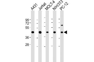 Western Blotting (WB) image for anti-Argininosuccinate Synthase 1 (ASS1) (AA 192-221) antibody (ABIN390810)