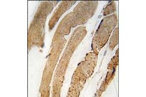 Formalin-fixed and paraffin-embedded human skeletal muscle tissue reacted with PDK4 antibody (Center), which was peroxidase-conjugated to the secondary antibody, followed by DAB staining. (PDK4 Antikörper  (Middle Region))