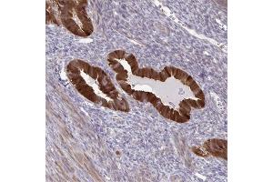 Immunohistochemical staining of human uterus with CMPK1 polyclonal antibody  shows strong cytoplasmic positivity in glandular cells at 1:50-1:200 dilution.