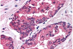 Human Prostate (formalin-fixed, paraffin-embedded) stained with FOXP2 antibody ABIN214758 at 2. (FOXP2 Antikörper  (AA 71-120))