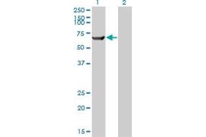 Western Blot analysis of TRIM16 expression in transfected 293T cell line by TRIM16 monoclonal antibody (M01), clone 5F4. (TRIM16 Antikörper  (AA 165-273))