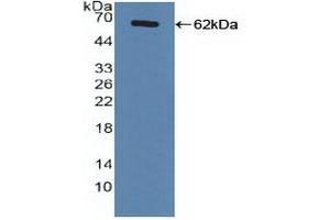 Figure. (NR1H4 Antikörper  (AA 211-486))
