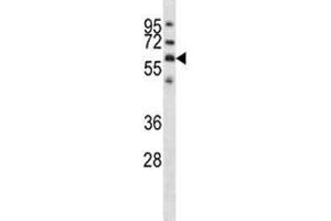 GPC3 antibody western blot analysis in NCI-H292 lysate. (Glypican 3 Antikörper  (AA 465-494))