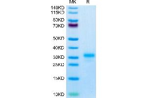 IL17F Protein (AA 29-161) (His-Avi Tag)