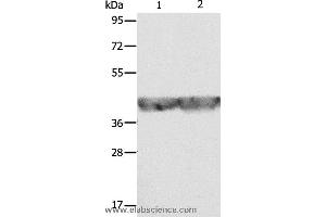 Western blot analysis of A549 and hela cell, using ALDOA Polyclonal Antibody at dilution of 1:500 (ALDOA Antikörper)