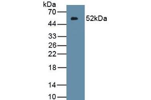Detection of Recombinant IFNk, Human using Polyclonal Antibody to Interferon Kappa (IFNk) (IFNK Antikörper  (AA 28-207))