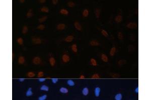 Immunofluorescence analysis of U-2 OS cells using BRD4 Polyclonal Antibody at dilution of 1:100 (40x lens). (BRD4 Antikörper)