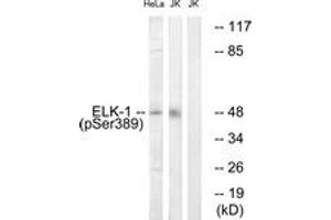 Western blot analysis of extracts from Jurkat cells treated with UV 15' and HeLa cells treated with paclitaxel 1uM 24h, using Elk1 (Phospho-Ser389) Antibody. (ELK1 Antikörper  (pSer389))