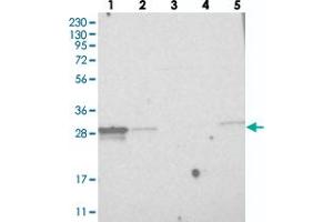 Western blot analysis of Lane 1: RT-4, Lane 2: U-251 MG, Lane 3: Human Plasma, Lane 4: Liver, Lane 5: Tonsil with MITD1 polyclonal antibody  at 1:250-1:500 dilution. (MITD1 Antikörper)