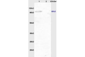 Lane 1: mouse brain lysates Lane 2: mouse lung lysates probed with Anti phospho-IKK beta(Tyr199) Polyclonal Antibody, Unconjugated (ABIN743243) at 1:200 in 4 °C. (IKBKB Antikörper  (pTyr199))