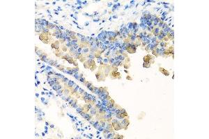 Immunohistochemistry of paraffin-embedded mouse lung using NYX antibody. (Nyctalopin Antikörper  (AA 282-481))