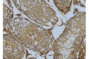 ABIN6275278 at 1/100 staining Mouse testis tissue by IHC-P. (CYB5R3 Antikörper  (C-Term))