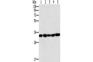 Western Blotting (WB) image for anti-Mitochondrial Carrier 2 (MTCH2) antibody (ABIN2430475) (MTCH2 Antikörper)