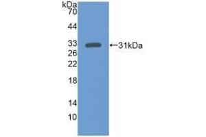 Detection of Recombinant ERK1, Human using Polyclonal Antibody to Extracellular Signal Regulated Kinase 1 (ERK1) (ERK1 Antikörper  (AA 75-312))