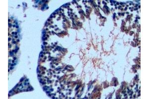 Immunohistochemistry (IHC) image for anti-Transforming Growth Factor, beta 1 (TGFB1) (AA 279-390) antibody (ABIN7429466)