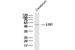 Mouse cerebrum lysates probed with LGI1 Polyclonal Antibody, unconjugated  at 1:300 overnight at 4°C followed by a conjugated secondary antibody at 1:10000 for 90 minutes at 37°C. (LGI1 Antikörper  (AA 451-557))