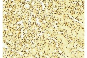 ABIN6276335 at 1/100 staining Mouse liver tissue by IHC-P.