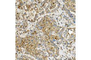 IHC analysis of Hexokinase 1/HK1 using anti-Hexokinase 1/HK1 antibody (ABIN7600258). (Hexokinase 1 Antikörper  (AA 17-323))