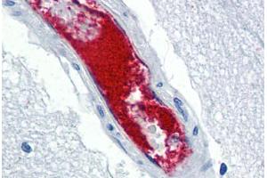Human Brain, Cortex, Vessel (formalin-fixed, paraffin-embedded) stained with VWF antibody ABIN337312 at 5 ug/ml followed by biotinylated anti-goat IgG secondary antibody ABIN481715, alkaline phosphatase-streptavidin and chromogen. (VWF Antikörper)