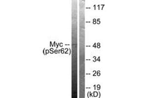 Western blot analysis of extracts from 293 cells treated with Forskolin 40nM 30', using Myc (Phospho-Ser62) Antibody. (c-MYC Antikörper  (pSer62))