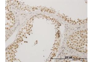 Immunostaining (ISt) image for anti-Nudix (Nucleoside Diphosphate Linked Moiety X)-Type Motif 21 (NUDT21) (AA 1-227) antibody (ABIN524443)