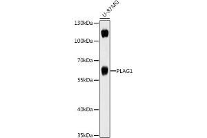 Western blot analysis of extracts of U-87MG cells, using PL antibody (ABIN7269418) at 1:1000 dilution. (PLAG1 Antikörper  (AA 33-288))