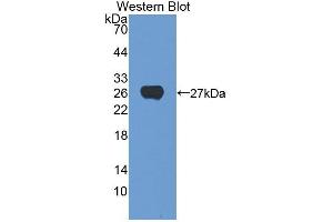 Detection of Recombinant CSN1, Human using Polyclonal Antibody to Casein Alpha (CSN1) (Casein alpha S1 Antikörper  (AA 16-185))