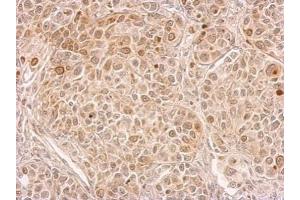 IHC-P Image CIAPIN1 antibody detects CIAPIN1 protein at cytosol on by immunohistochemical analysis.