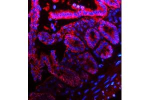 IF analysis of EpCAM using anti-EpCAM antibody (ABIN7600081). (EpCAM Antikörper  (AA 147-189))